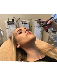 kyslíkový facelifting - tvár